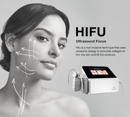ผลการรักษาบริเวณเป้าหมาย HIFU สีขาว